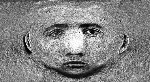 Kopf-Abwicklung, Pinch